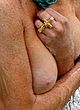 Lindsay Lohan naked pics - boob slip bikini malfunction