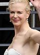 Nicole Kidman exposes huge cameltoe pics
